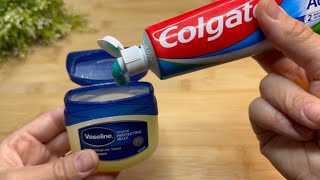 Mix toothpaste and vaseline, I didn’t expect it to be this effective